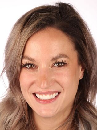 Smile Makeover Lucy - After