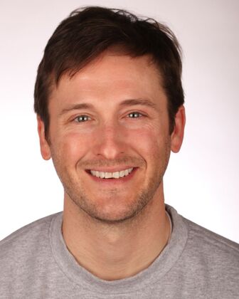 Smile Makeover Mike - Before