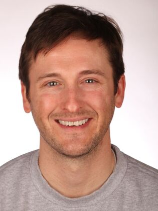 Smile Makeover Mike - Before