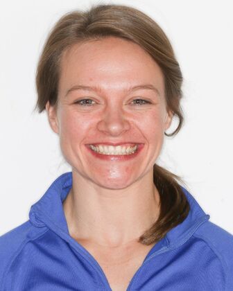 No-Prep Veneers Andrea - Before