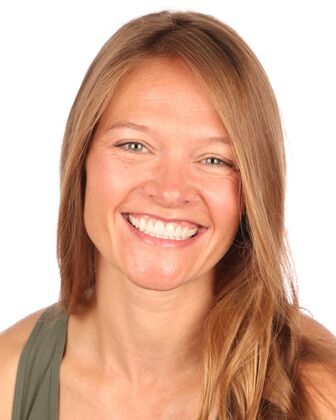 No-Prep Veneers Andrea - After