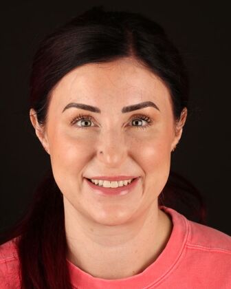 No-Prep Veneers Ashley - Before