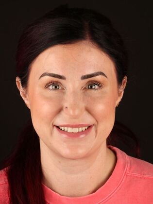 No-Prep Veneers Ashley - Before