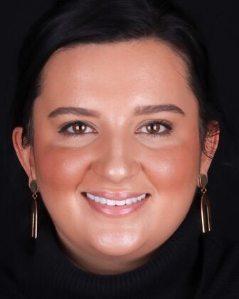 No-Prep Veneers Aylana - After