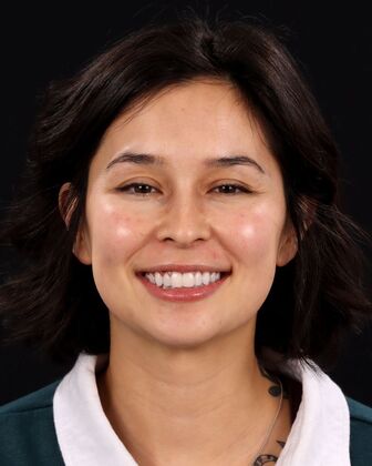 No-Prep Veneers Gabby - After