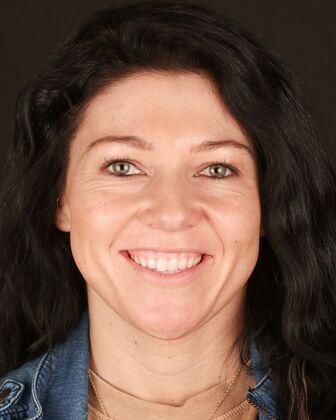 No-Prep Veneers Mica - Before