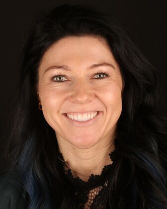 No-Prep Veneers Mica - After