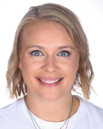 No-Prep Veneers Patty - Before