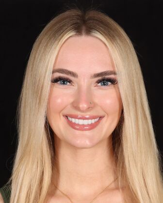 No-Prep Veneers Taylor - After