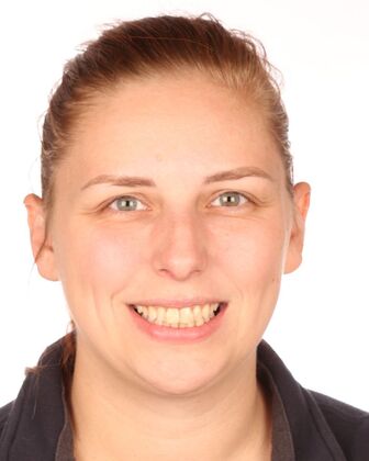 Full Mouth Reconstruction Ariel - Before