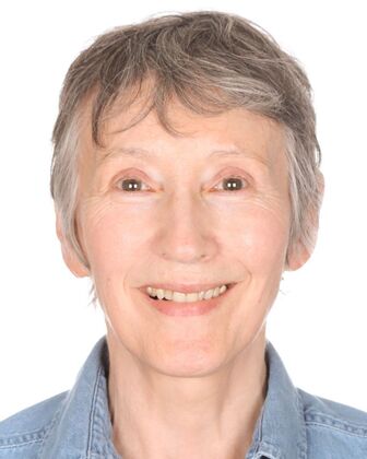 Full Mouth Reconstruction Barb - Before