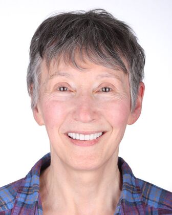 Full Mouth Reconstruction Barb - After