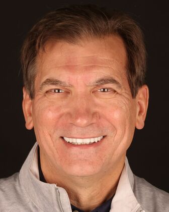 Full Mouth Reconstruction Charles - After