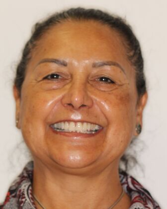 Full Mouth Reconstruction Edna - Before