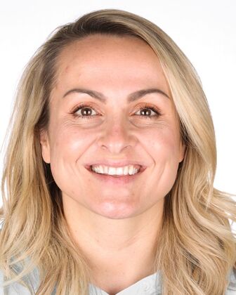 Full Mouth Reconstruction Jasmina - Before