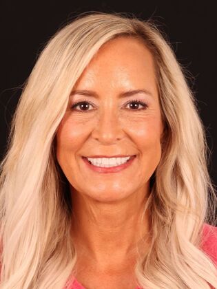 Full Mouth Reconstruction Melissa G. - After