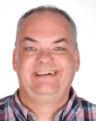 Full Mouth Reconstruction Orin - Before