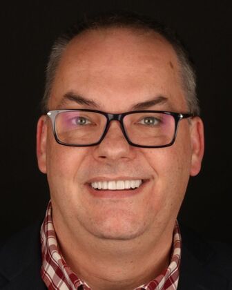 Full Mouth Reconstruction Orin - After