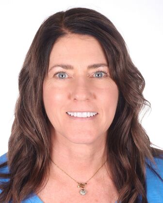 Full Mouth Reconstruction Susan - After