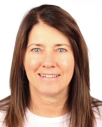 Full Mouth Reconstruction Susan - Before