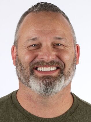 Full Mouth Reconstruction Tom - After