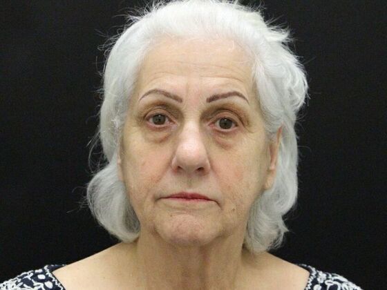 Non-Surgical Case 1 - Before