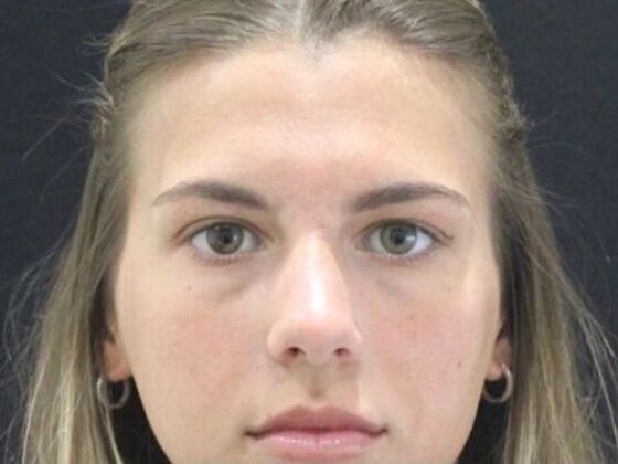 Injectables: Case 96 - Before