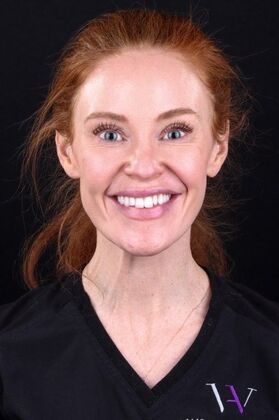Smile Makeover & Veneers: Crystal - Before