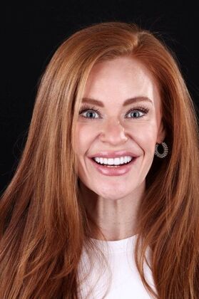 Smile Makeover & Veneers: Crystal - After