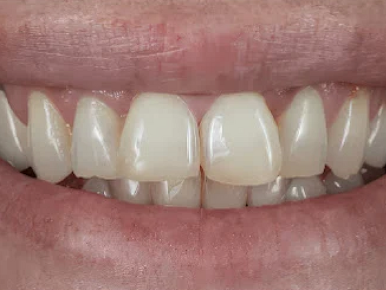 Smile Transformations Case 1 - Before
