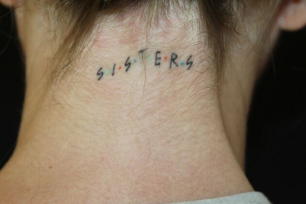 Laser Tattoo Removal Case 44 - Before