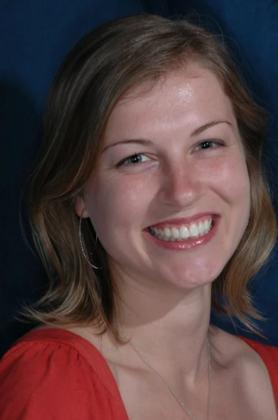 Veneers: Hana - After