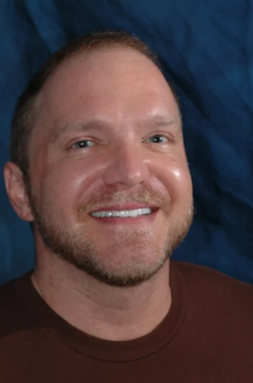 Veneers: Shawn - After