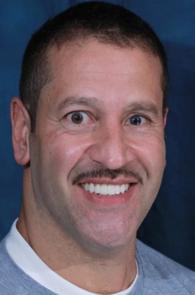 Smile Makeover: Angel - After