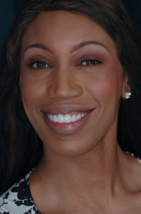 Smile Makeover: Aja - After