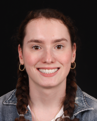 No-Prep Veneers Lucille - After