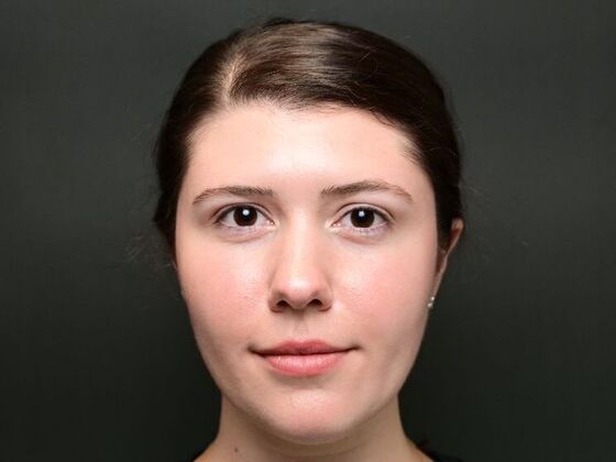 Morpheus8 Face and Neck Case