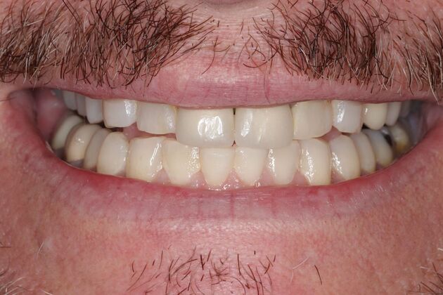 Smile Gallery : Case 3 - Before
