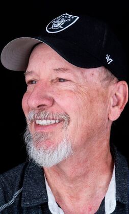 Dental Implants: John - Before