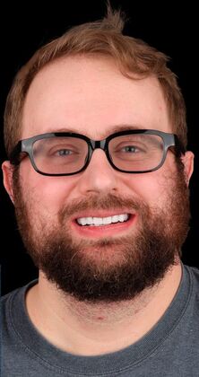 Full Mouth Restoration Jason - After