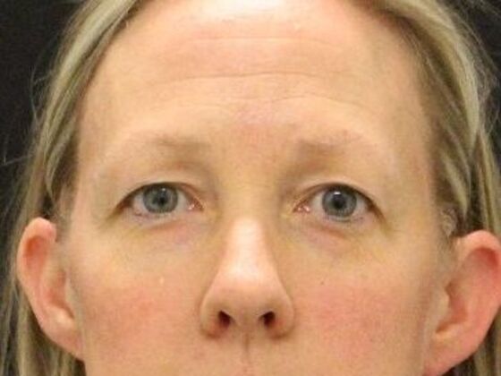 Eyelid Surgery: Case 23 - Before