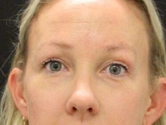 Eyelid Surgery: Case 23 - After
