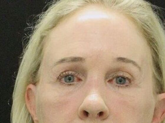 Forehead & Brow Lifts Case 6 - After