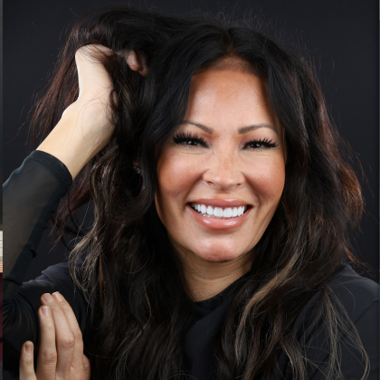 Minimal Prep Porcelain Veneers Heather - After