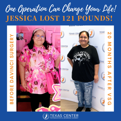 Transformation Tuesday: Case 2 - After
