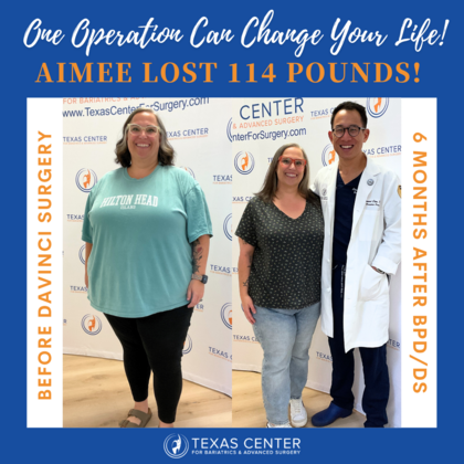 Transformation Tuesday: Case 4 - After