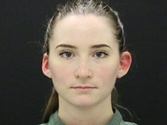 Ear Surgery - Otoplasty Case 5 - Before