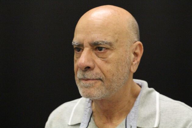 Face & Neck Lifts: Case 6 - After