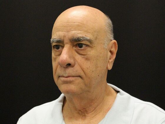 Face & Neck Lifts: Case 6 - Before