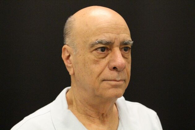 Face & Neck Lifts: Case 6 - Before